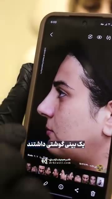 💉 «کورتون، درمان همیشگی نیست