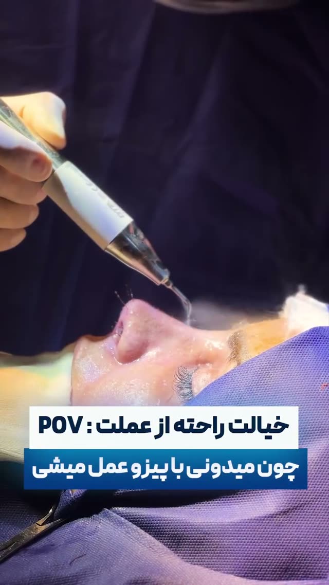 ❓می‌دونستی حتی بینی‌های گوشتی هم میشه با پیزوسرجری عالی عمل کرد