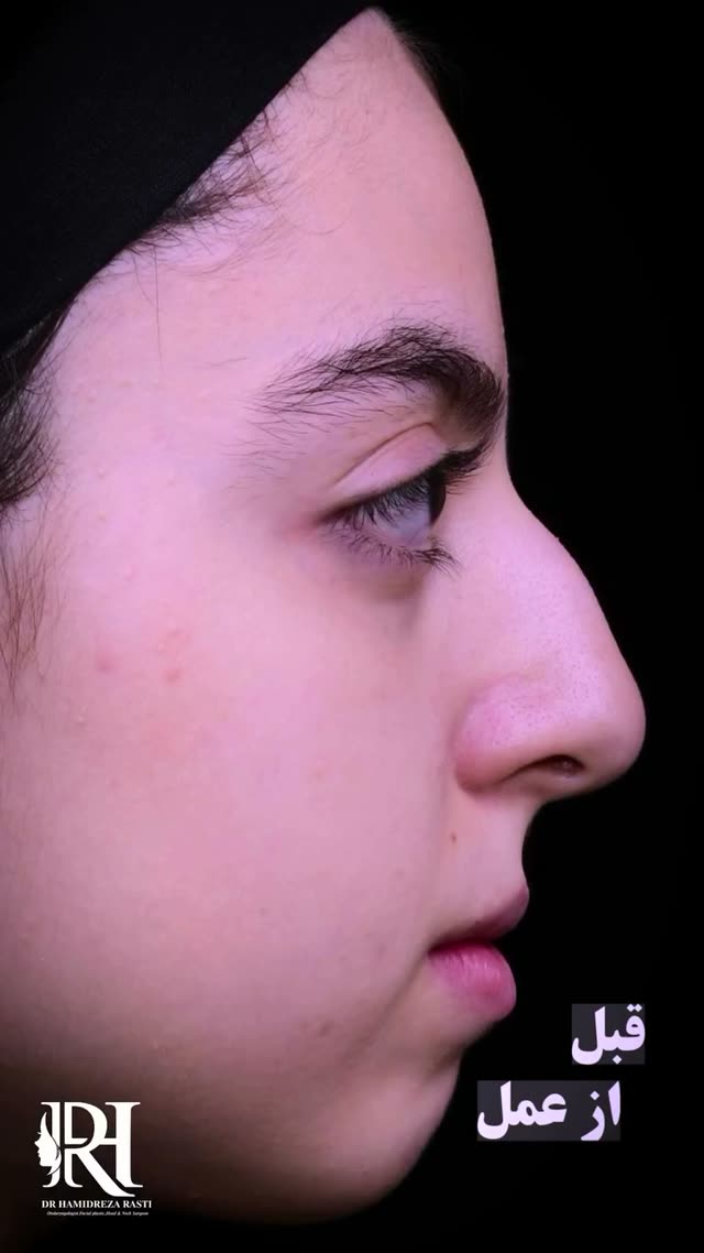 این نتیجه فوق العاده در کمتر از یک ماه برای زیبای جوی عزیزمون اتفاق افتاده
