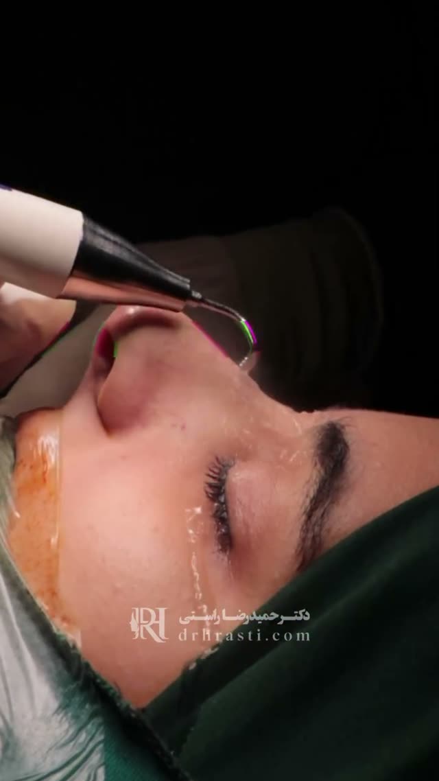 حالا به این فکر کردی که میشه جراحی بینی رو با دقت بیشتر و آسیب کمتر انجام داد