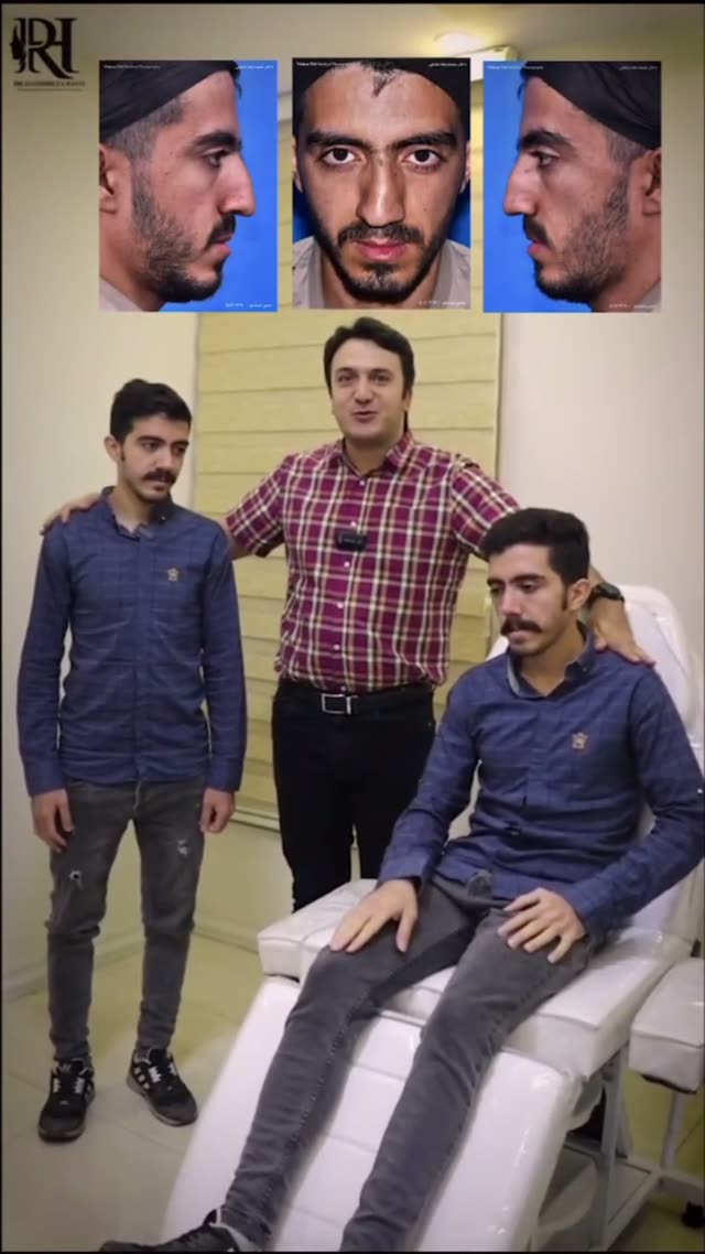 بینی دارای شکستگی و انحراف