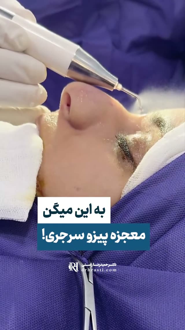✅ بینی نیمه فانتزی با قوس طبیعی از مدل باربی هم بهتره