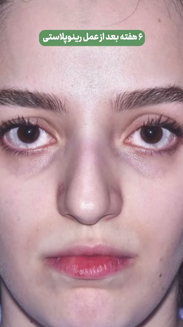 ۵ سال منتظر این لحظه بود… ✨