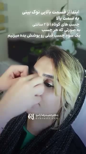 چسب زدن بعد از عمل بینی ،قدمیه که نتیجه نهایی ‌و تضمین میکنه