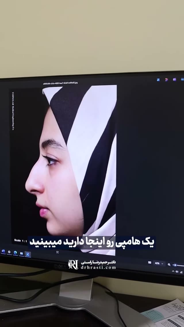 ✨این تغییرات فقط بعد از گذشت ۳ ماه