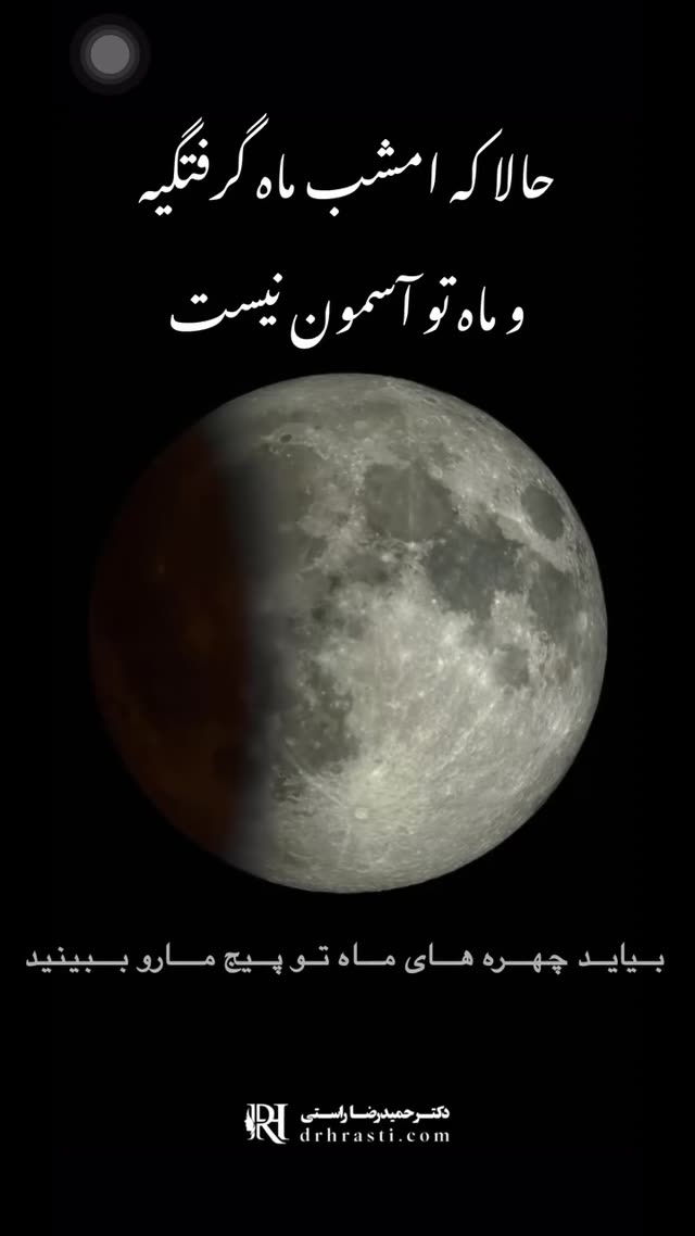 بفرست برای اونی که چهرش شبیه ماهه🌙