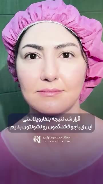 قسمت اول عمل این زیباجو رو در جند پست قبلی مشاهده کنید 🌸🥰❤️