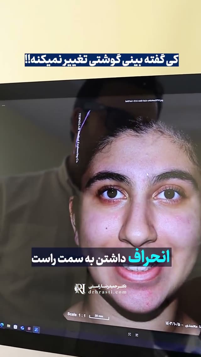❓فکر می‌کنی بینی گوشتی نمی‌تونه قشنگ بشه