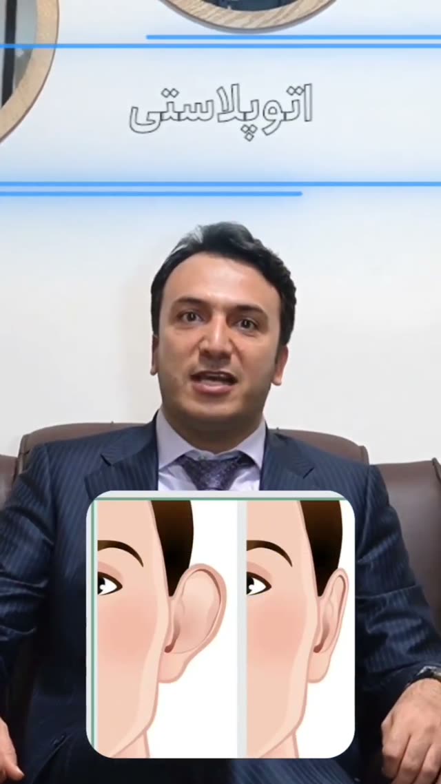 اتوپلاستی نوعی از جراحی گوش است که برای اصلاح شکل، برجستگی و اندازه گوش انجام می‌شود