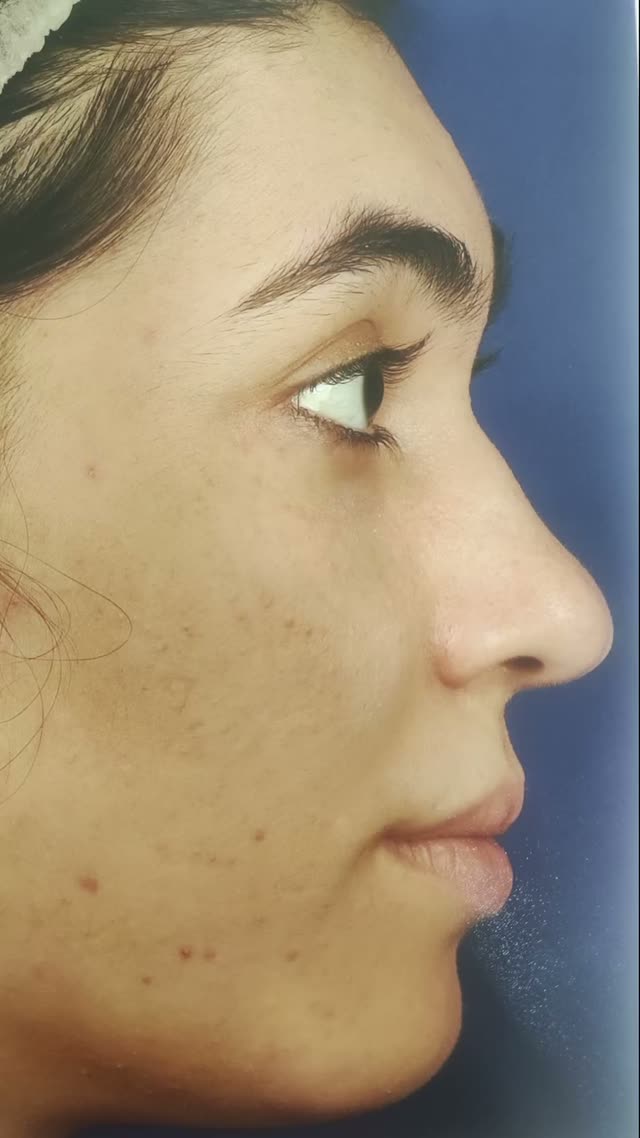 نتیجه فوق العاده