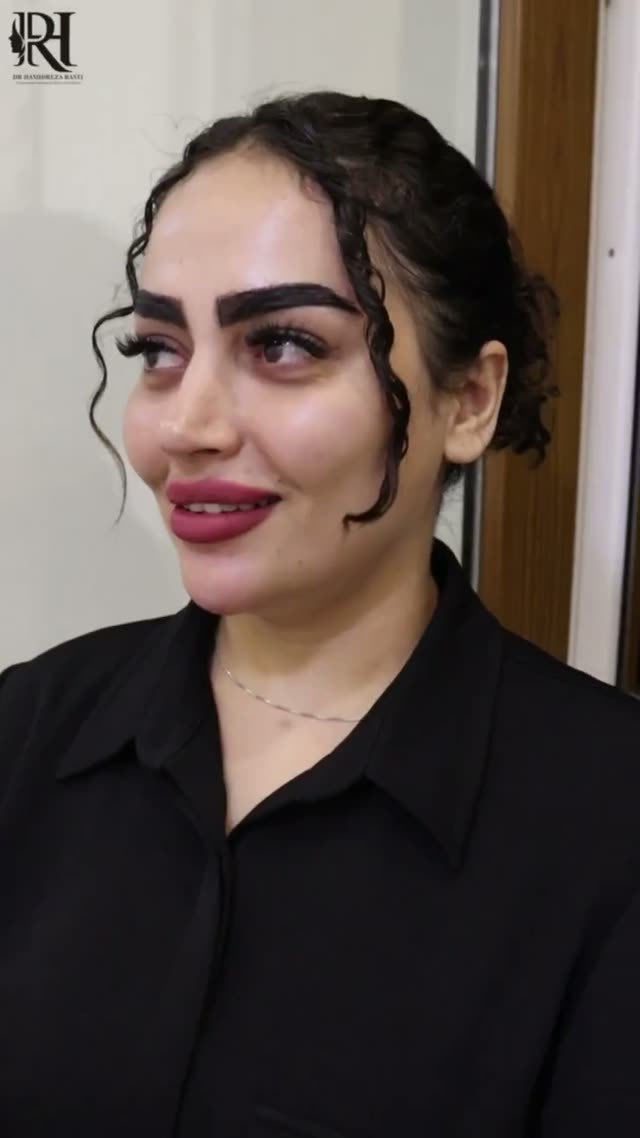 بعد از ۶ ماه از جراحی زیبایی بینی 😍👌