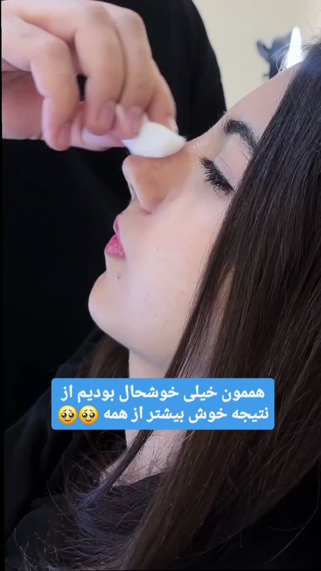 ✨ فقط یه هفته بعد از عمل