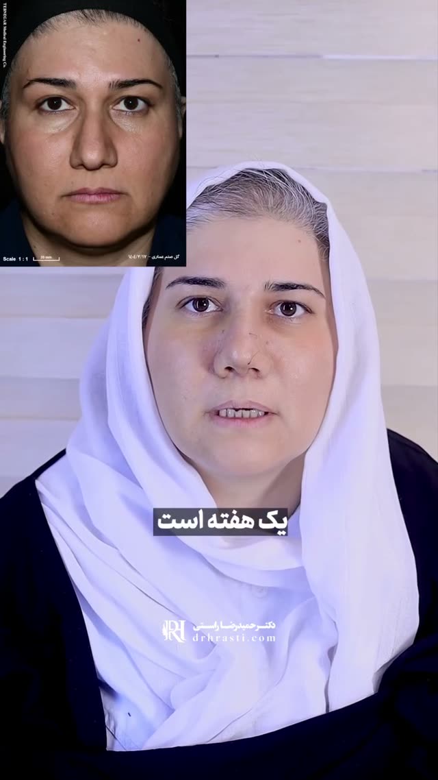 ❓فکر می‌کنی جراحی بینی فقط برای زیباییه