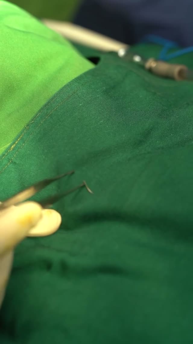 با استفاده از غضروف پشت گوش