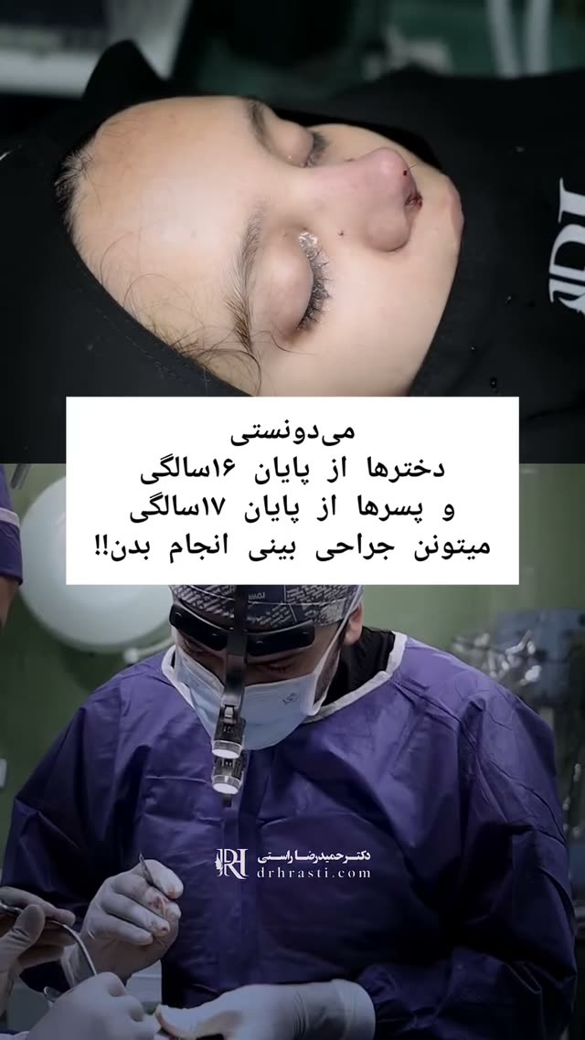 سوالی که همیشه پرسیده میشه, ۱۶ یا ۱۷ سالمه میتونم جراحی بینی داشته باشم یا زوده