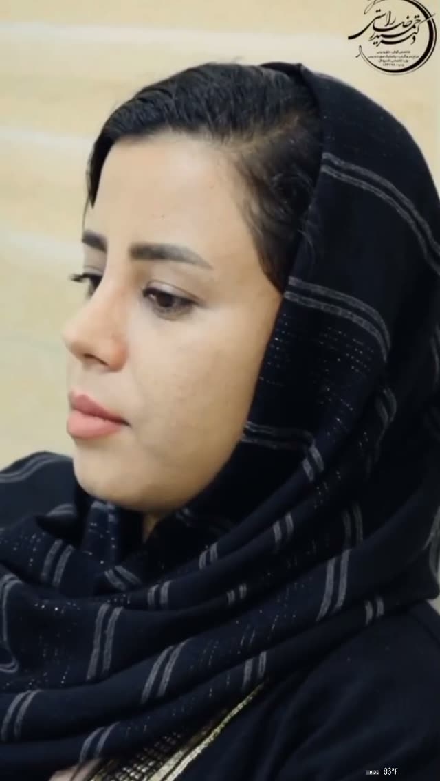 یک ماه بعد از جراحی زیبایی بینی😍