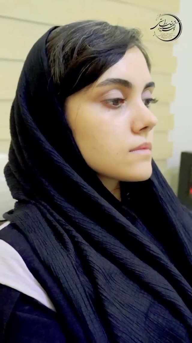 دوماه بعد از عمل😍