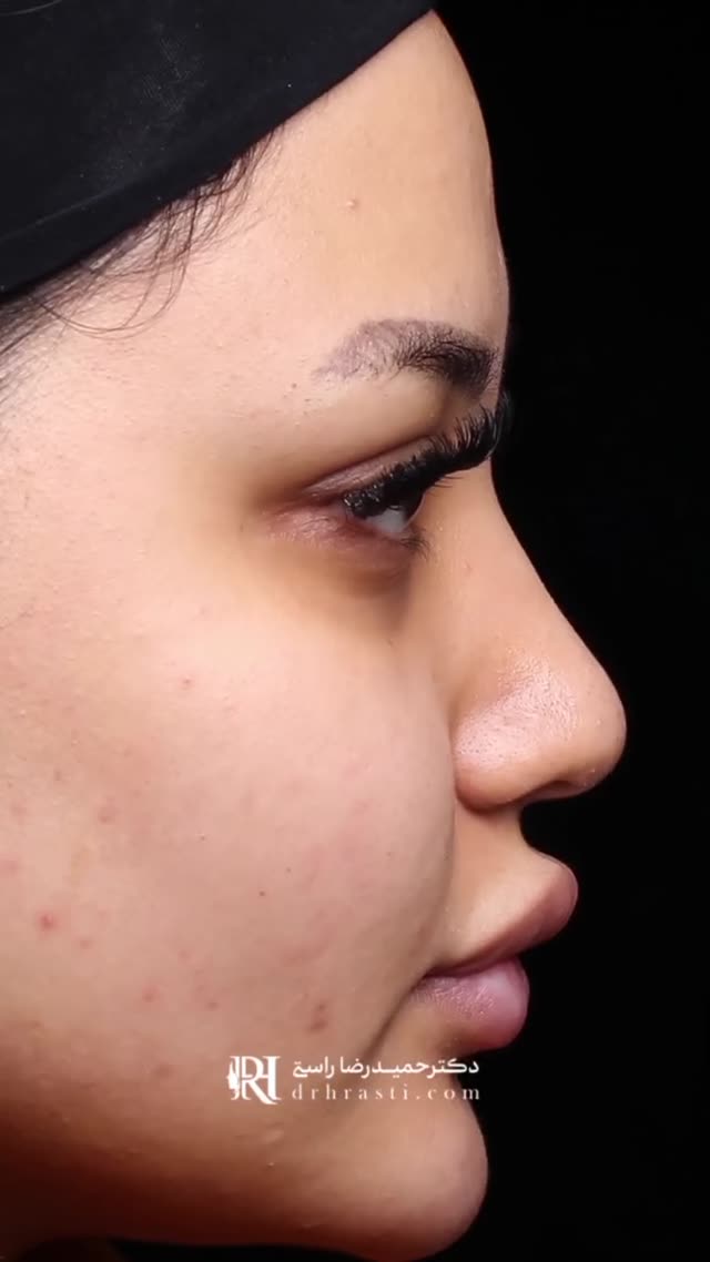 اقدامات کوچک ، تغیرات بزرگ💫🥰