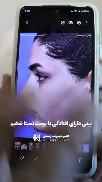 جراحی بینی گوشتی، چالشِ، اما غیرممکن نیست