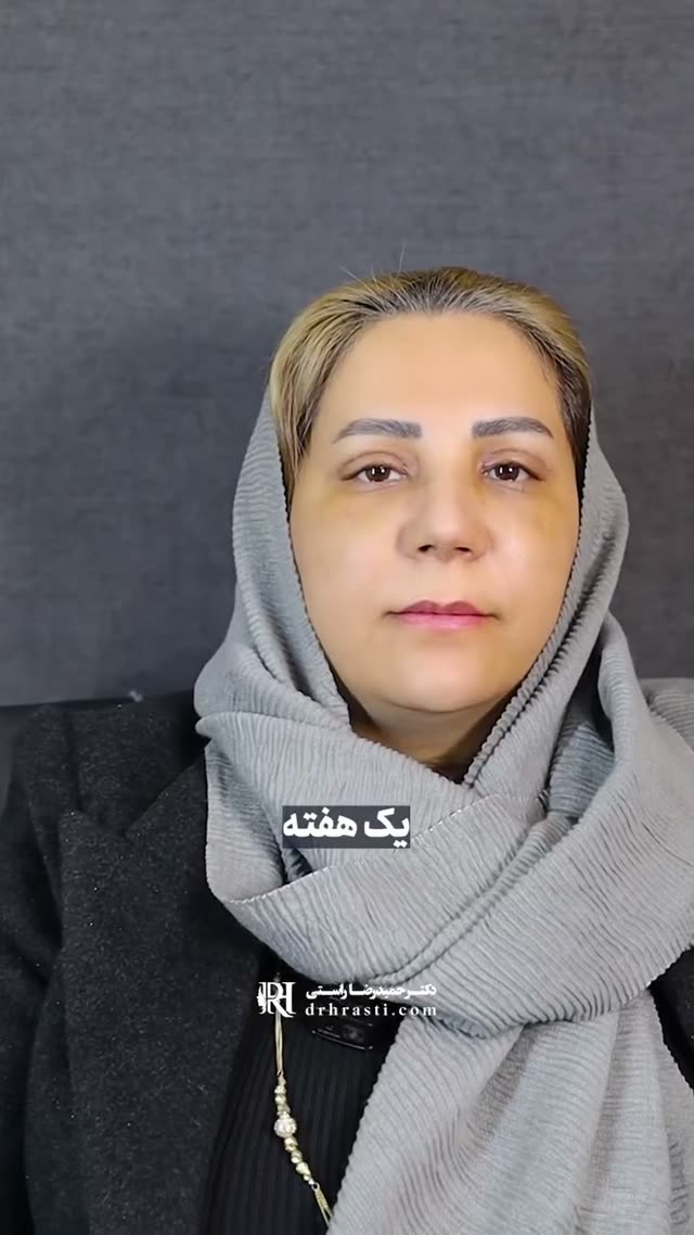 👃 بعد از ۳ ماه، معجزه‌ی بینی گوشتی رو ببین
