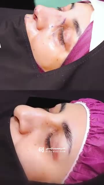 حتی مادرش هم عمل کرد