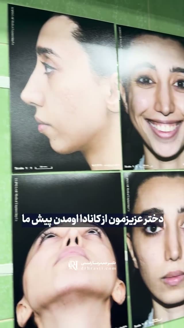 ❓تا حالا شده برای یه ترمیم درست‌حسابی، از اون‌ور دنیا بلند شی بیای ایران