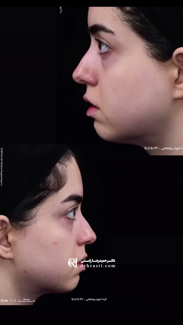 این فقط نتیجه ۳ هفته اس