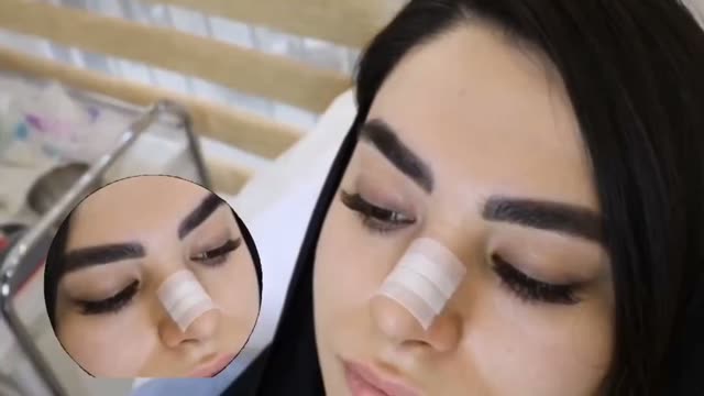 آموزش چسب زدن بینی بعدازجراحی ✨