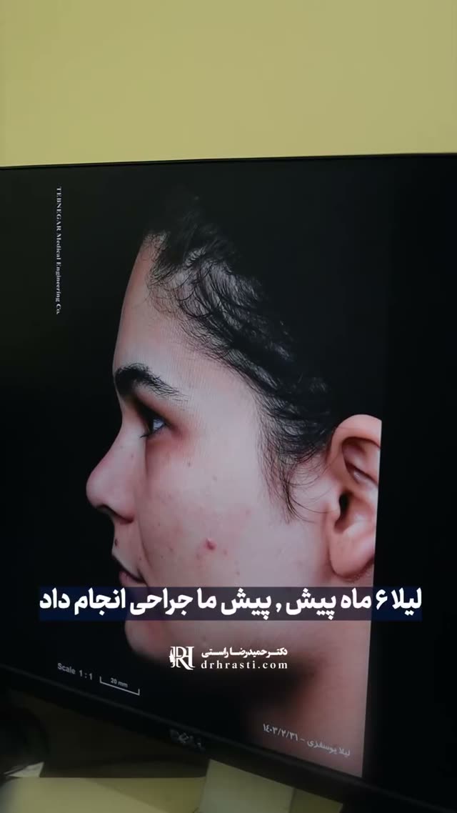 ✨ بالاخره لیلا اومد تهران تا
