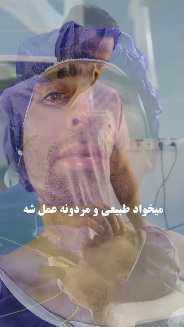 ✨از قوز بینی تا چهره‌ای متناسب و مردانه