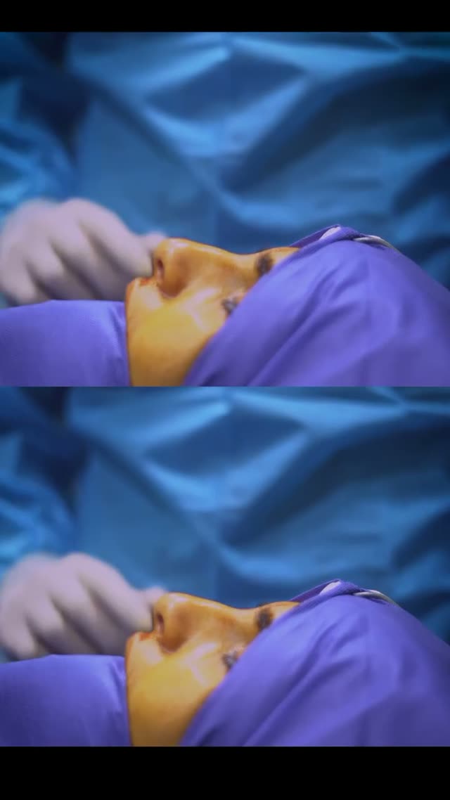 جراحی زیبایی بینی به سبک دکتر حمیدرضا راستی