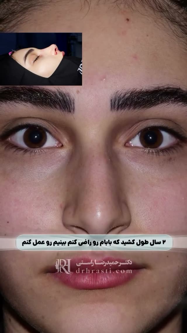 ۳ سال انتظار برای جراحی‌ای که قرار بود فقط فرم بینی رو تغییر نده