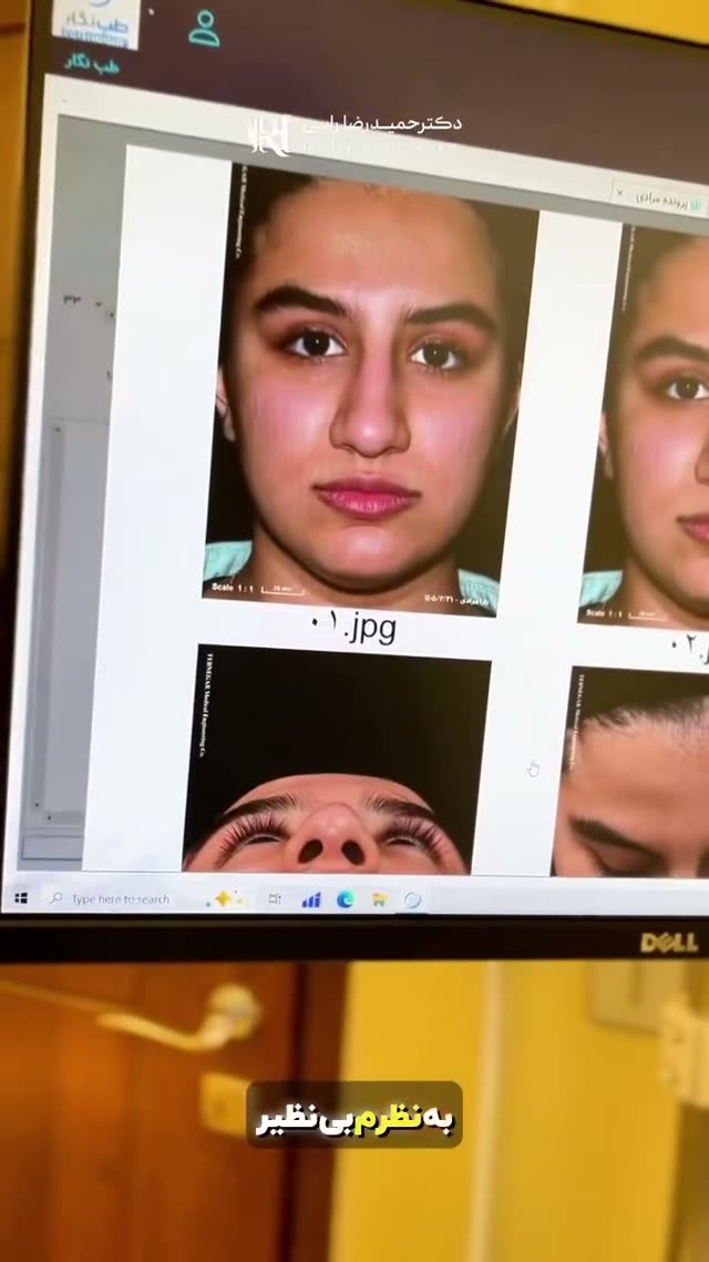 نمونه نتیجه و تجربه بیمار