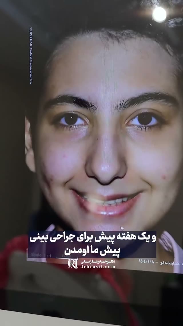 ❗️این داستان بینی گوشتی که نیمه فانتزی شد