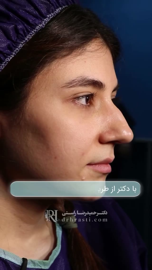 بینی‌های گوشتی هم …