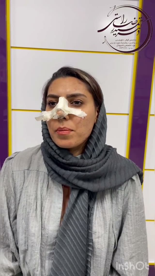 🔷تغييرات زيباجوى عزيزمون چطوره