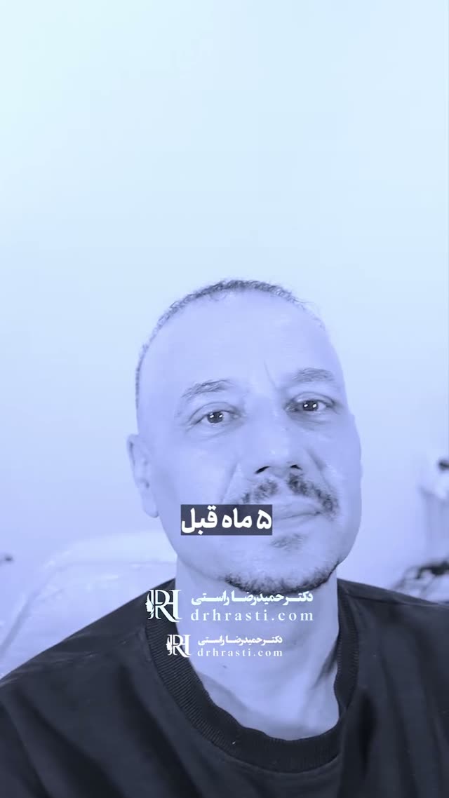 🕶 وقتی میگن “شبیه جیسون استاتهام شدی