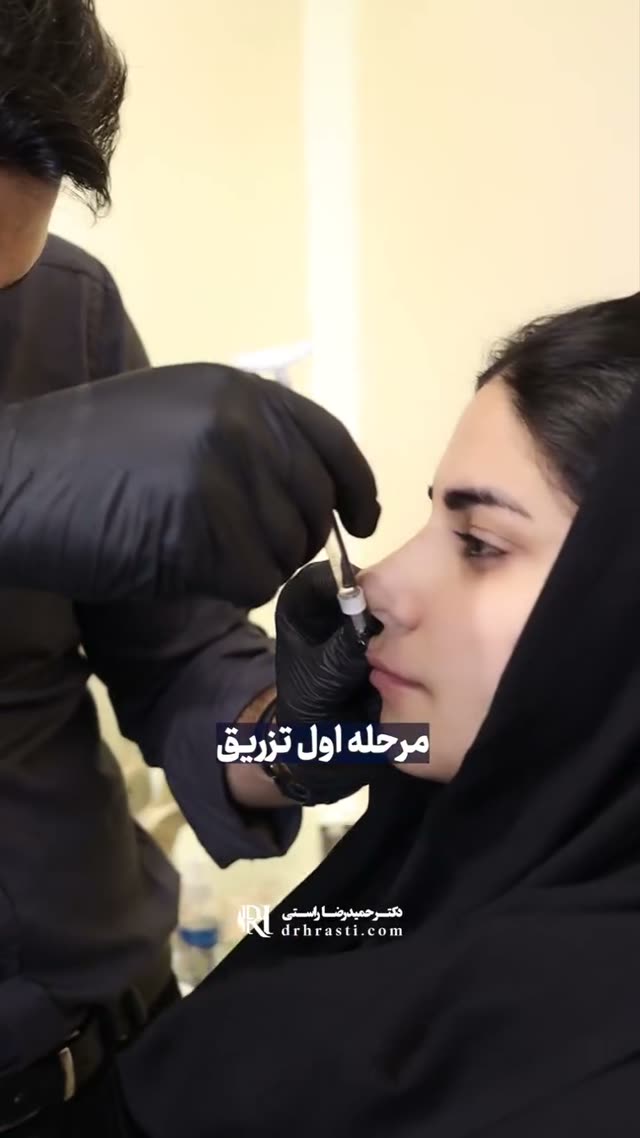👃✨ وقتی جراحی بینی موفقی داشته باشی