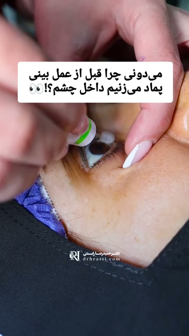 ❌پماد داخل چشم چیه