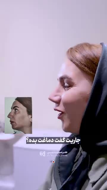 👩🏻‍💻جهت اطلاع از هزینه جراحی عدد ۸ رو کامنت کن 😍