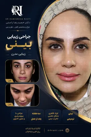 Real before-and-after result of Dr. Hamidreza Rasti's rhinoplasty