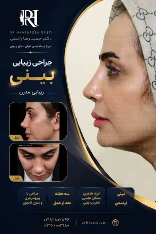 Real before-and-after result of Dr. Hamidreza Rasti's rhinoplasty