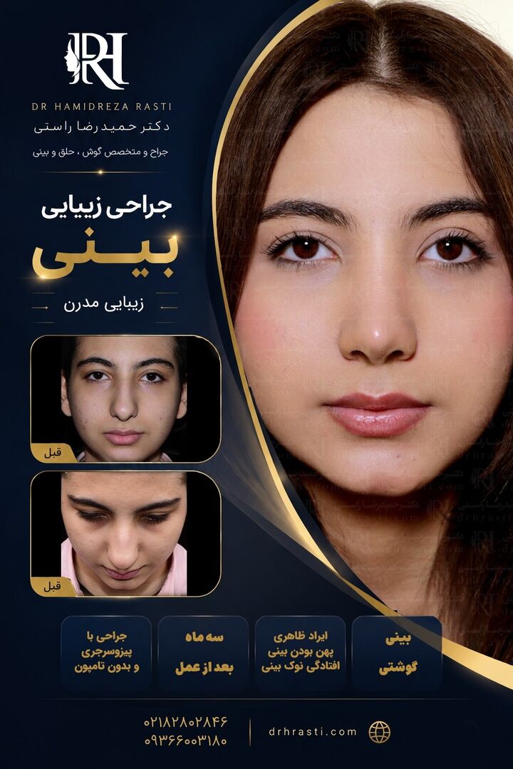 نمونه کار جراحی ترمیمی بینی دکتر حمیدرضا راستی