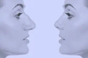 عوارض جراحی بینی در پیری + 3 راه حل 11 عوارض جراحی بینی در پیری