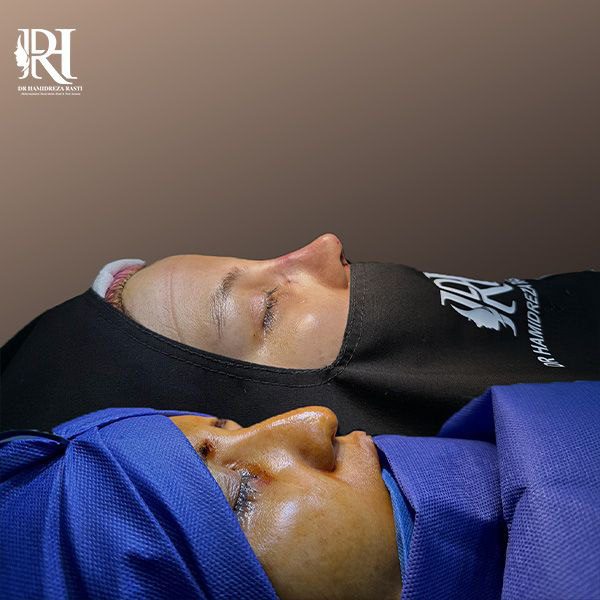 جراحی ترمیم بینی توسط بهترین جراح تهران