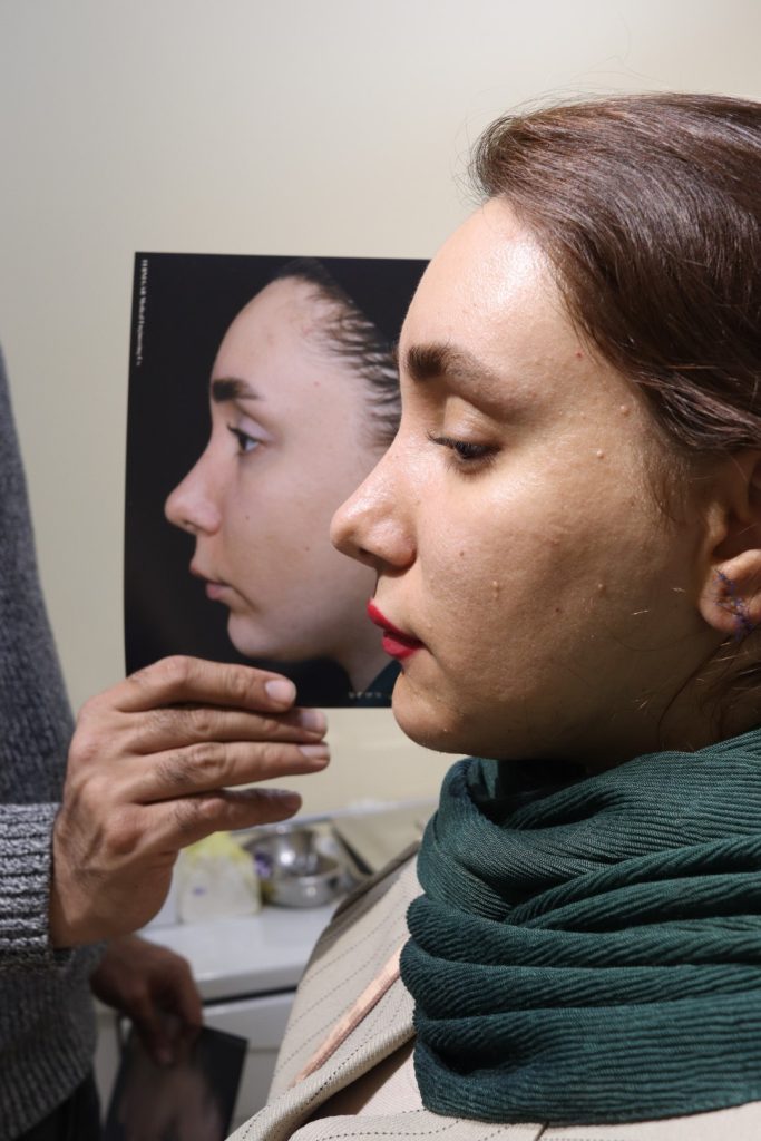 بهترین جراح پروتز چانه در تهران