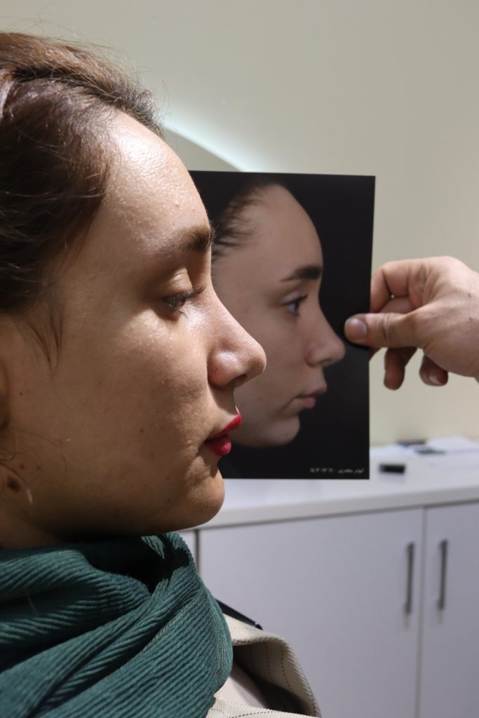 پروتز چانه در تهران