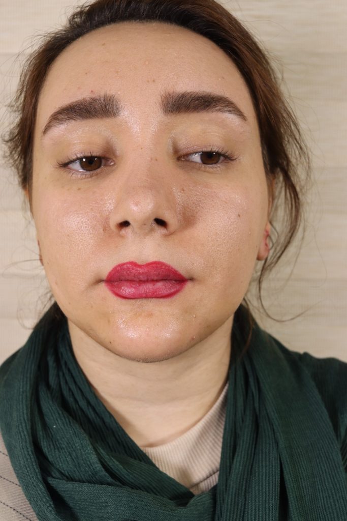 بهترین جراح پروتز چانه