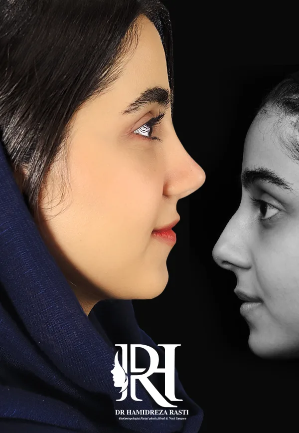 جراحی بینی - دکتر حمیدرضا راستی