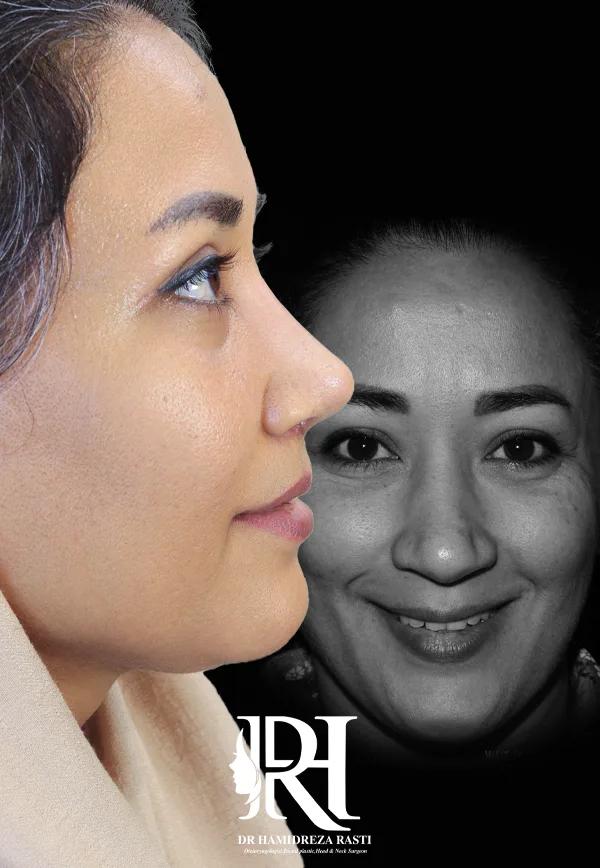 جراحی پلاستیک صورت